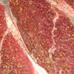 Beef increases hearburn